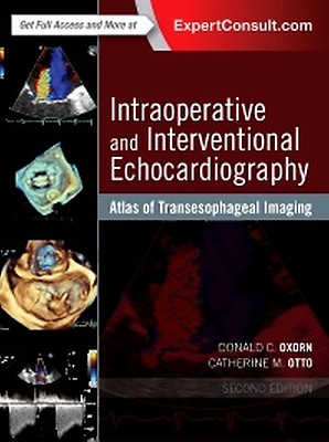 洋書 PERIOPERATIVE TEE SelfAssessment&Review Perioperative Transesophageal Echocardiography: A Companion