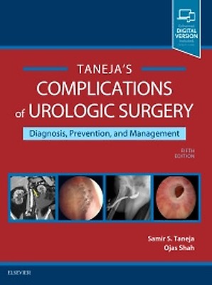 Hinman's Atlas of Urologic Surgery - 9780323936118