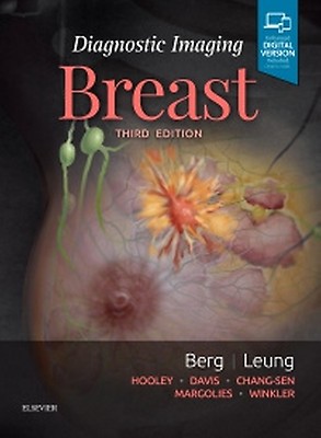 Diagnostic Breast Imaging 第2版 Diagnostic Breast Imaging: Mammography, Sonography, MRI and