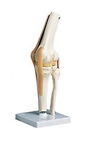 GPI Anatomicals 4-Stage Arthritic Hip Model